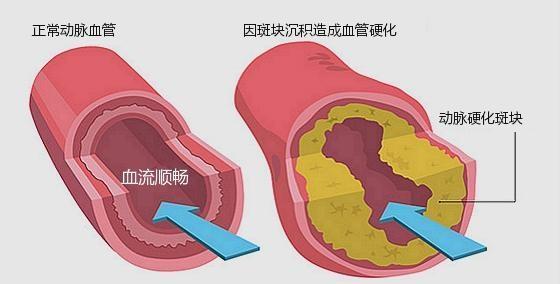 文山三七可以通畅血管